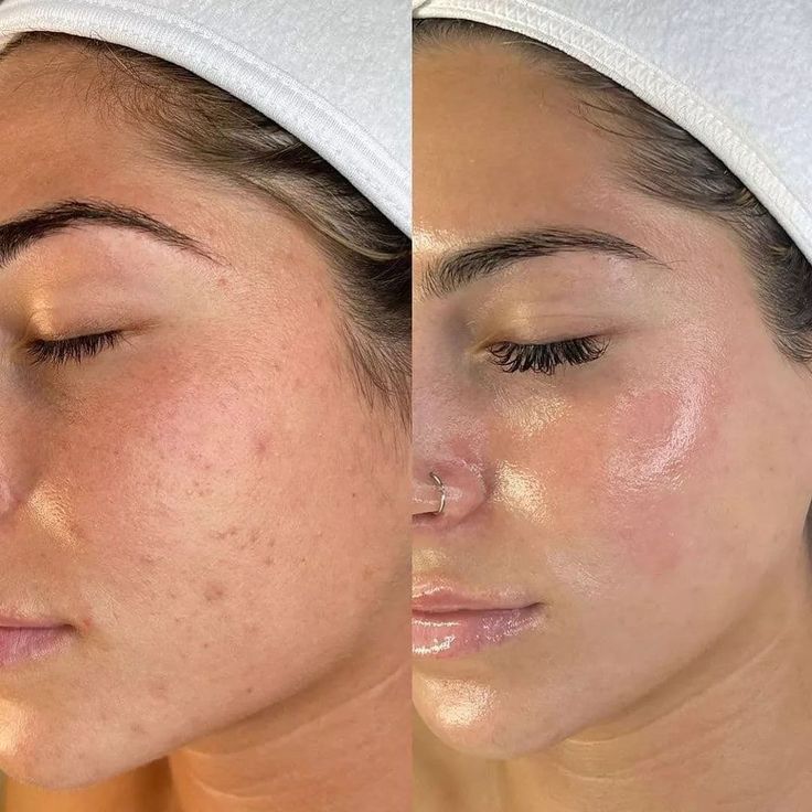 REVITALIZING ELIXIR – SERUM