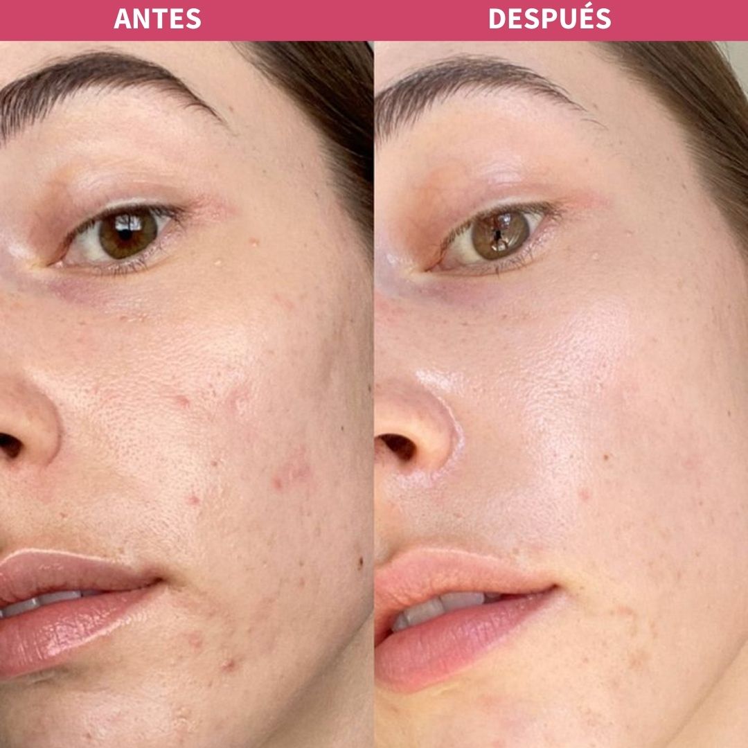 GEL DE RECUBRIMIENTO 3 EN 1 + Envió gratis